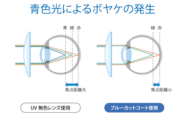 青色光によるボヤケの発生