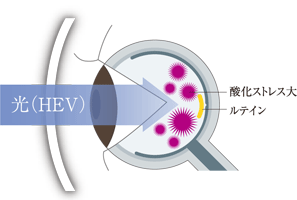 一般的なレンズを装用した眼