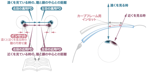 専用フレキシブルインセット設計