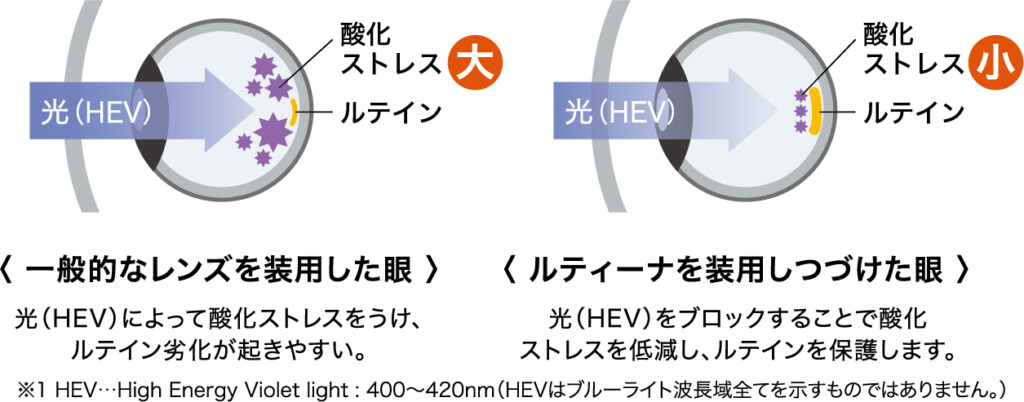 一般的なレンズを装用した眼とルティーナを装用しつづけた眼の比較の図