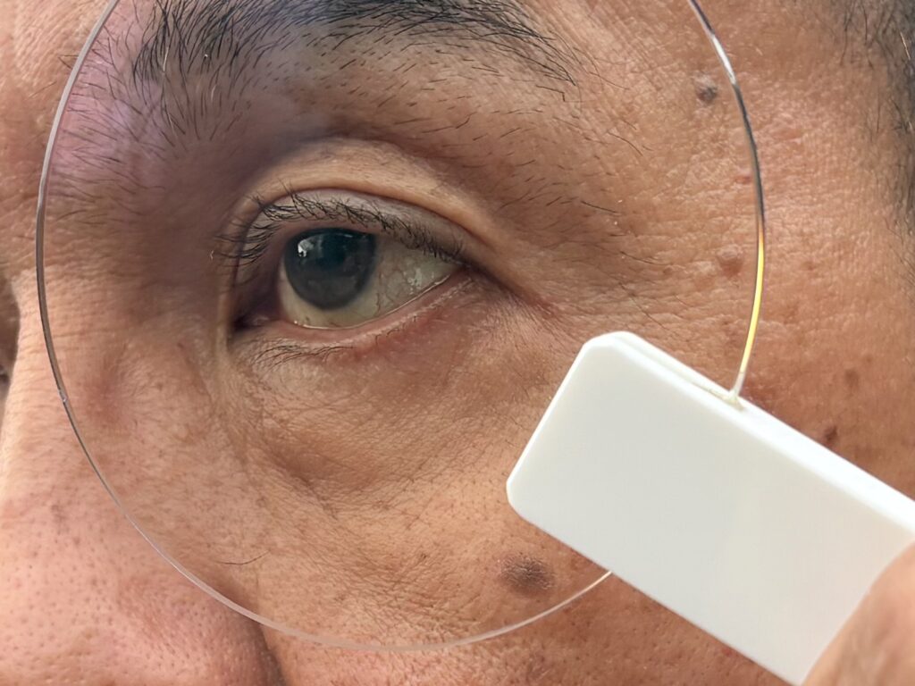 ルティーナを目元にかざした男性の目元の拡大画像